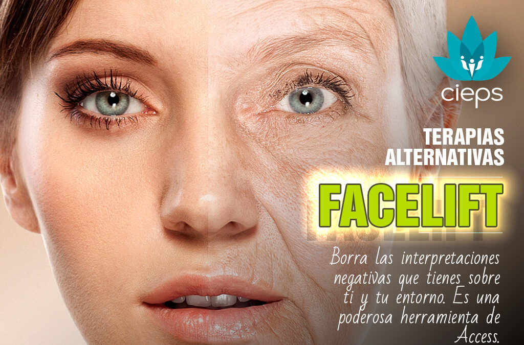 Facelift